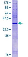 Human KRTCAP2 Protein (Recombinant GST)