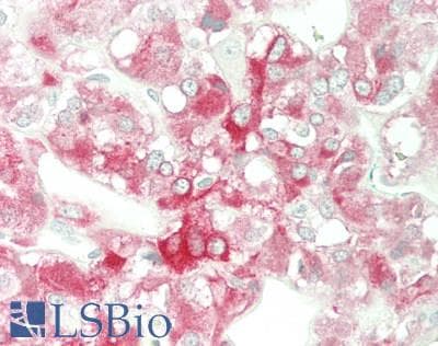 IHC-plus™ RAB3A Antibody (clone 1531CT562.14.57)