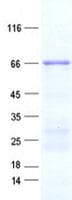 Human HSPC167 / CDK5RAP1 Protein (Recombinant His, N-Terminal)