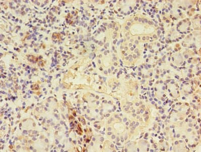 CTPS Antibody (aa79-388)