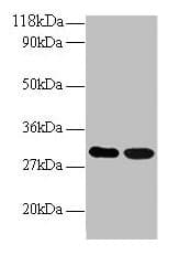 IHC-plus™ ARHGEF18 Antibody