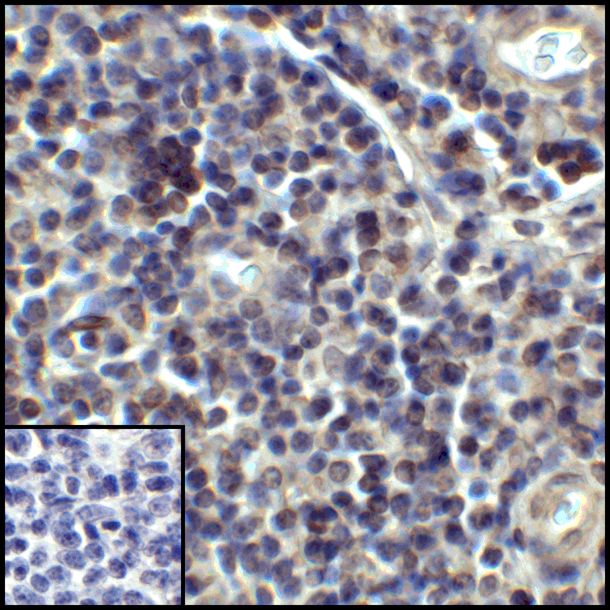 CD274 / B7-H1 / PD-L1 Antibody (clone 1D7)