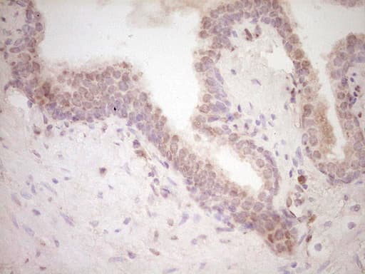 Monoclonal Mouse anti-Human RB1 / Retinoblastoma / RB Antibody (clone OTI1C3, aa309-590, IHC, WB)