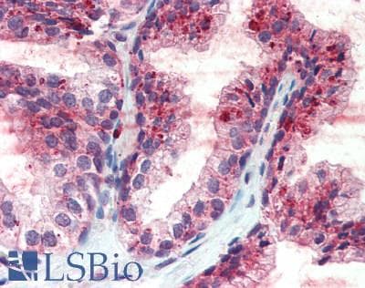 IHC-plus™ Polyclonal Goat anti-Human CDCP1 Antibody (aa637-649, IHC, WB)