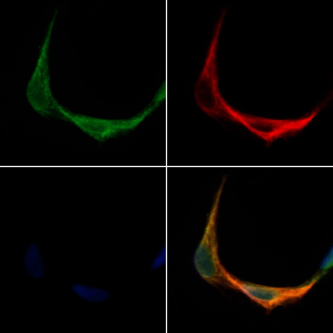 TMEM158 / RIS1 Antibody