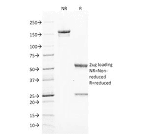 Monoclonal Mouse anti-Human ZAP70 Antibody (clone ZAP70/2046, IHC)
