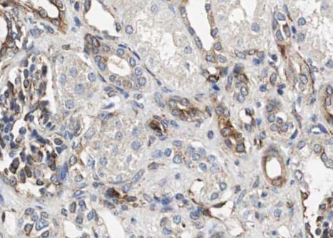 RELB Antibody (phospho-Ser552)