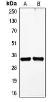 VEGFD Antibody (Internal)