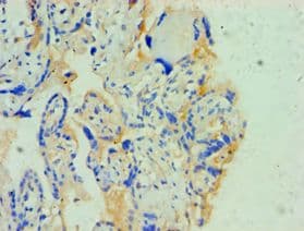 Polyclonal Rabbit anti-Human SOAT1 Antibody (aa1-130, IHC)