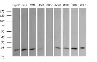 Monoclonal Mouse anti-Human RAB30 Antibody (clone OTI3F4, IF, WB)
