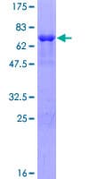 Human SUDS3 Protein (Recombinant GST)