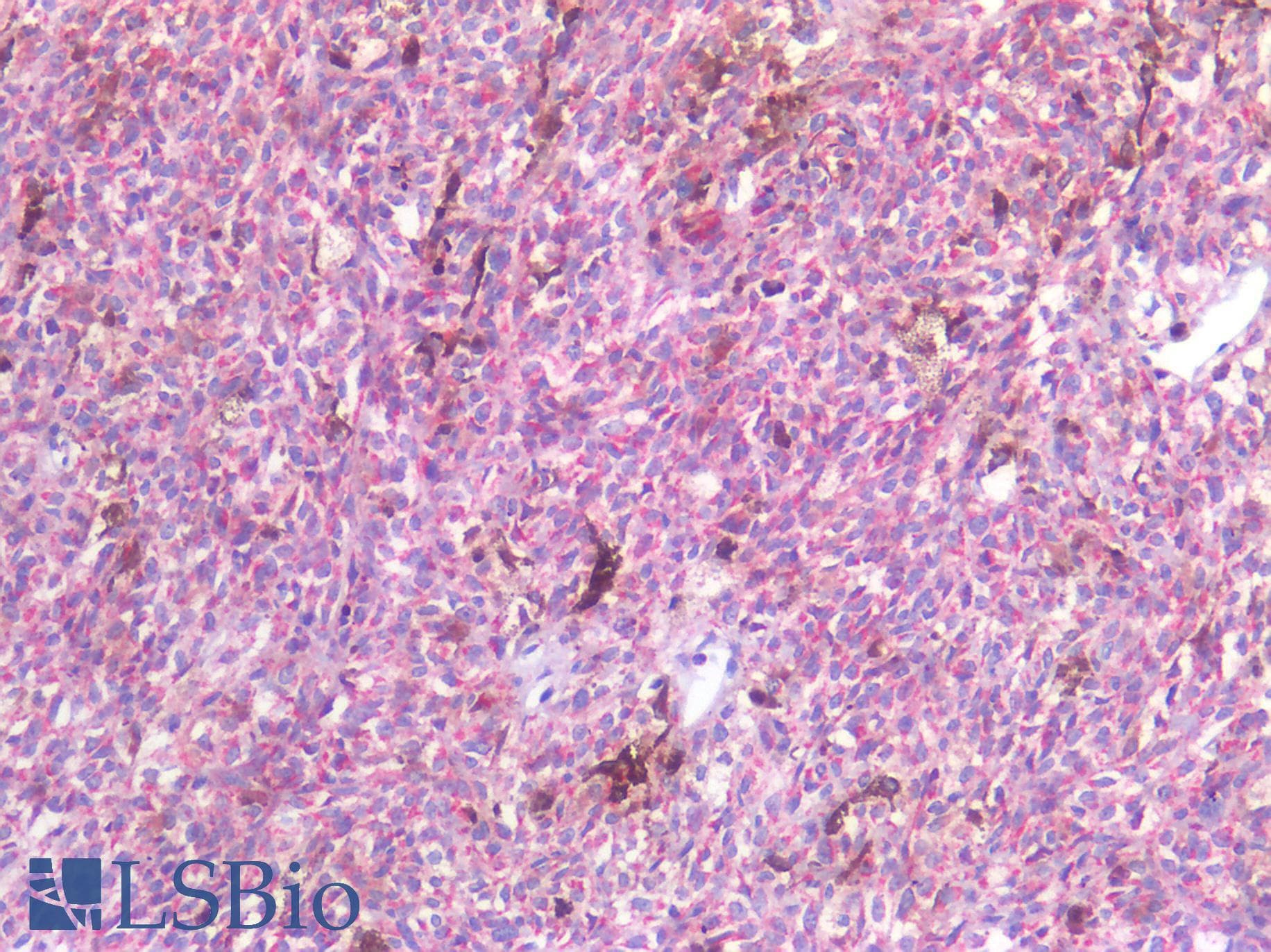 PathPlus™ Polyclonal Rabbit anti-Human GNAQ Antibody (IHC)