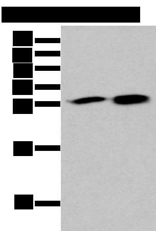 HDHD2 Antibody