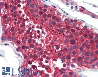 IHC-plus™ CAPZA1 / CAPZ Alpha 1 Antibody
