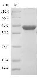 Human CDKN2D / p19 INK4d Protein (Recombinant GST, N-terminus)