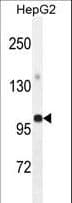 GPAM Antibody (aa426-455)