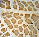 Polyclonal Rabbit anti-Human NPEPPS Antibody (aa709-737, IHC, WB)