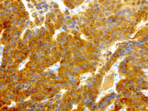 NME1 / NM23 Antibody (clone UMAB94)