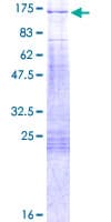 Human PPP1R13L / iASPP Protein (Recombinant GST)
