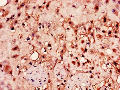 HPSE / Heparanase Antibody