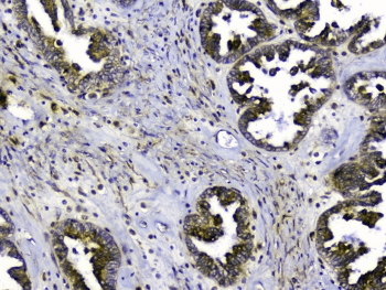 Polyclonal Rabbit anti-Human SIRT4 / Sirtuin 4 Antibody (IHC, WB)