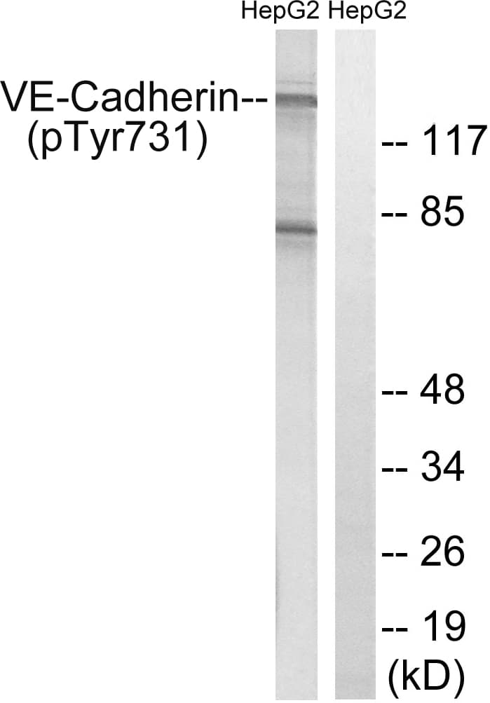 Polyclonal Rabbit anti-Human CD144 / CDH5 / VE Cadherin Antibody (phospho-Tyr731, IHC, WB)