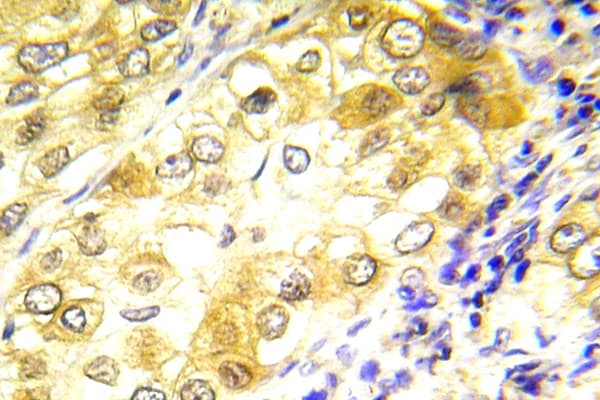 TP53 / p53 Antibody (Asp43)