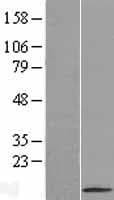 SFTA2 Protein (Over-Expression Lysate Myc-DDK (Flag))