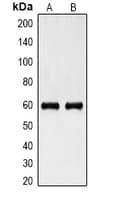 KRT6A / CK6A / Cytokeratin 6A Antibody