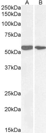 IHC-plus™ NOX1 Antibody (aa490-502)