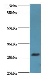 Polyclonal Rabbit anti-Human TREM1 Antibody (aa21-205, WB)