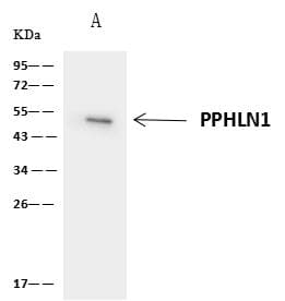 Polyclonal Rabbit anti-Human PPHLN1 Antibody (IF, WB)