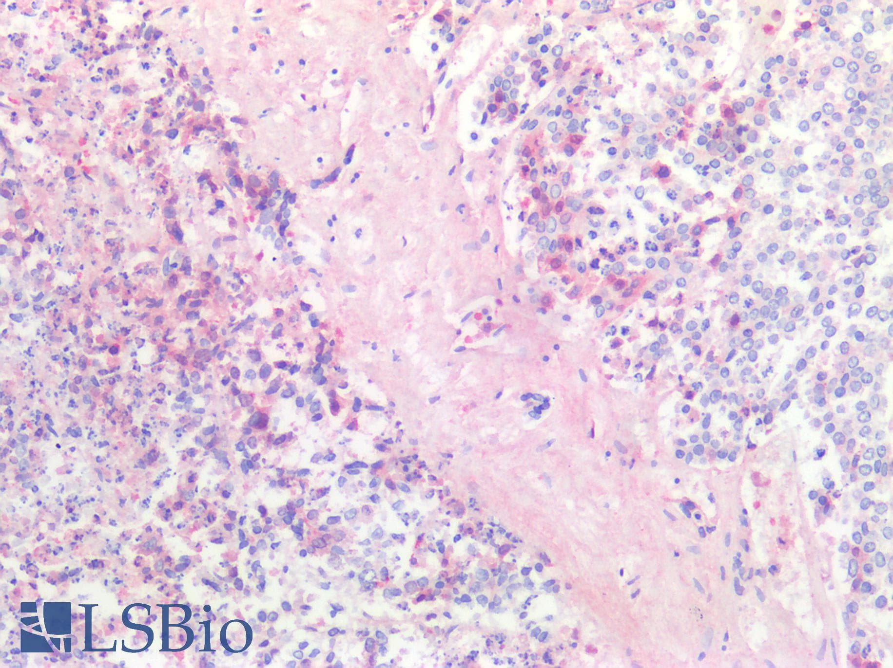 PathPlus™ Alpha-Fetoprotein Antibody (clone C2, Concentrated)