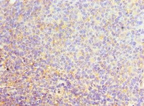 SRSF4 / SFRS4 Antibody (aa1-180)