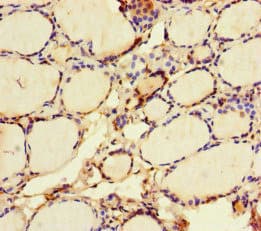 Polyclonal Rabbit anti-Human VGLL4 Antibody (aa43-277, IHC)