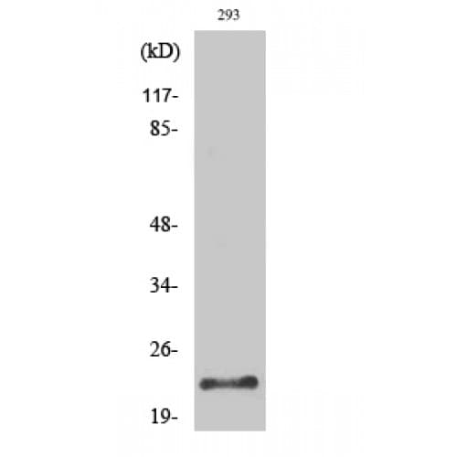Polyclonal Rabbit anti-Human PRSS1 / Trypsin Antibody (Internal, WB)