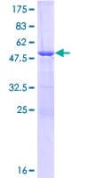 Human ULBP1 Protein (Recombinant GST)
