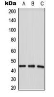 Polyclonal Rabbit anti-Human AGPAT4 Antibody (Internal, WB)