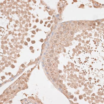 KDR / VEGFR2 / FLK1 Antibody