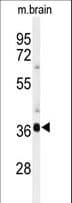 SIRT3 / Sirtuin 3 Antibody (aa304-334)