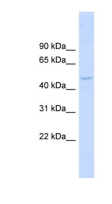 SH3P7 / HIP-55 Antibody (aa251-300)
