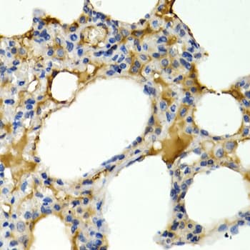 IL9 Antibody