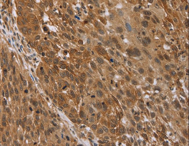 STMN2 + STMN3 + STMN4 Antibody