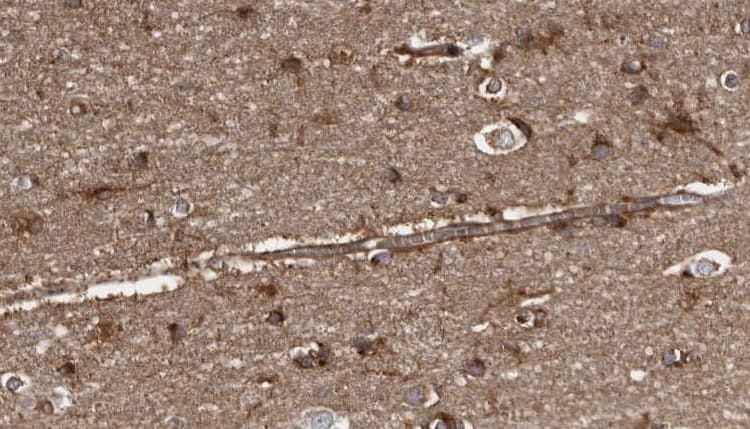 Polyclonal Rabbit anti-Human GP1BB / CD42c Antibody (IHC, WB)