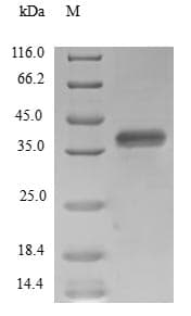 Human SUPT4H1 / SPT4 Protein (Recombinant GST, N-terminus)