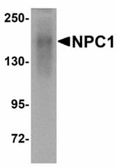 IHC-plus™ NPC / NPC1 Antibody