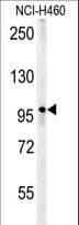 PARP13 / ZC3HAV1 Antibody (aa604-632)