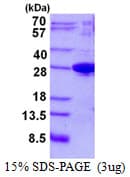 Human JOSD1 Protein (Recombinant His)