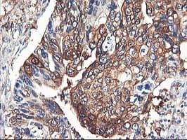 PFKP Antibody (clone OTI1F2)