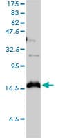 IHC-plus™ CLDN1 / Claudin 1 Antibody (clone 1C5-D9)